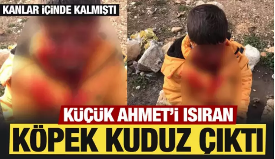 Adıyaman'da küçük Ahmet'i ısıran köpek kuduz çıktı 